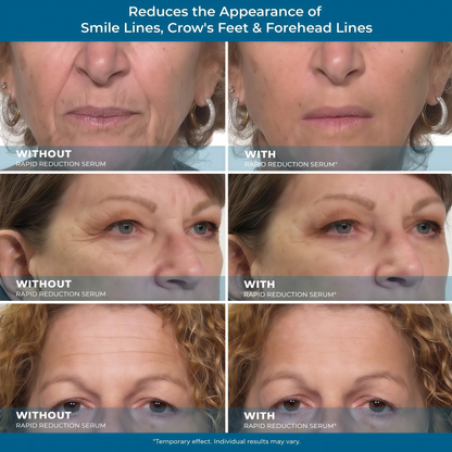 Rapid Reduction Serum - 1-Month Supply